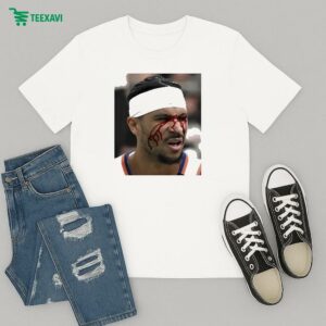 Josh Hart Took An Elbow To The Face T-Shirt